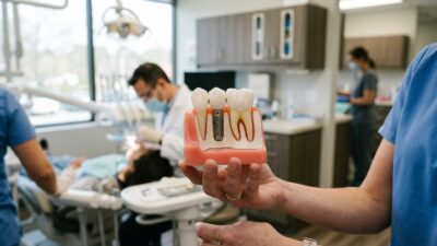 Имплантация зубов под ключ: что входит в цену на самом деле